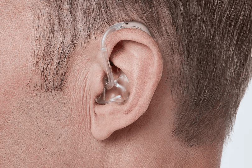 Aide auditive derrière l'oreille avancée